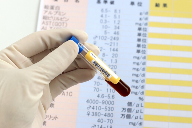 腫瘍マーカーが高いと指摘された方へ